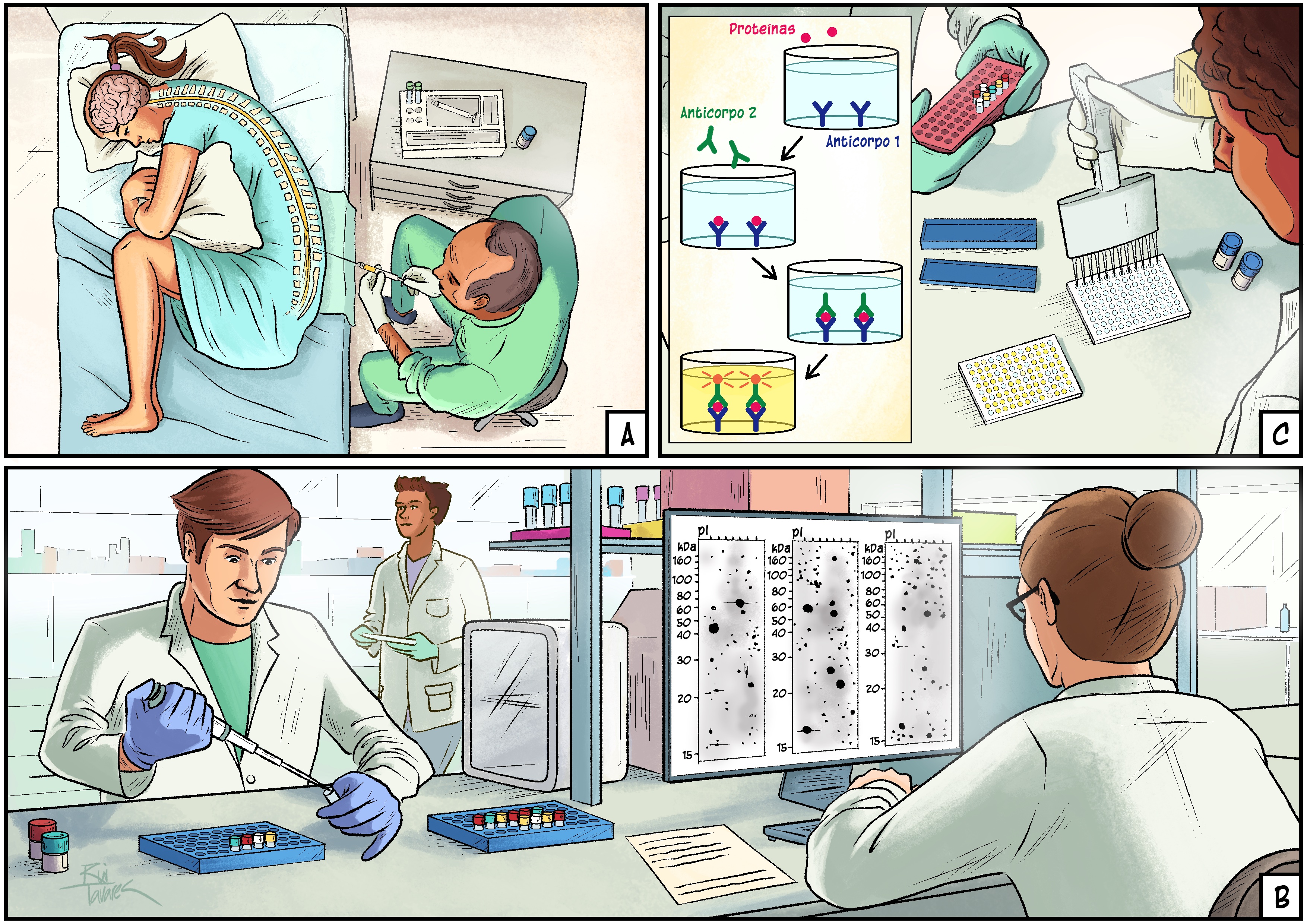 Samples of cerebrospinal fluid are collected from patients (A) and their protein composition is subsequently analyzed (B). The current phase of the project consists of confirming the results obtained using a technique based on the use of specific antibodies for each protein, called ELISA (C). Illustration by Rui Tavares.